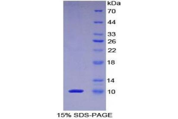 PKIA Protein