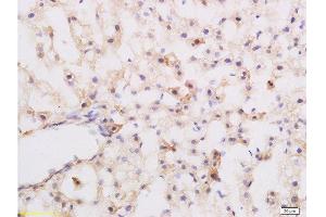 Formalin-fixed and paraffin embedded rat liver labeled with Rabbit Anti-Substance P Polyclonal Antibody at 1:200 followed by conjugation to the secondary antibody and DAB staining. (Substance P antibody  (AA 58-68))