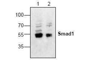 Image no. 1 for anti-SMAD, Mothers Against DPP Homolog 1 (SMAD1) antibody (ABIN127139) (SMAD1 antibody)