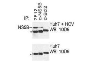 Western Blotting (WB) image for anti-Hepatitis C Virus NS5 (HCV NS5) (AA 77-86) antibody (ABIN781787) (HCV NS5 antibody  (AA 77-86))