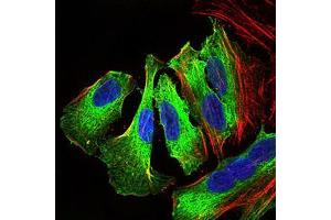 Immunofluorescence (IF) image for anti-Mitogen-Activated Protein Kinase 14 (MAPK14) (AA 299-360) antibody (ABIN1724830)