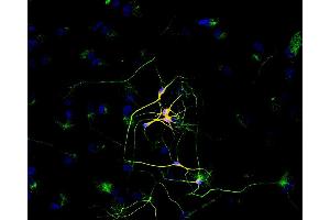 Immunofluorescence (IF) image for anti-Tubulin, beta 3 (TUBB3) (N-Term) antibody (FITC) (ABIN93912)