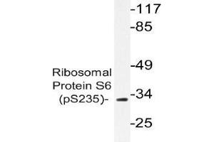 Western blot (WB) analyzes of p-Ribosomal Protein S6 antibody in extracts from K562 TNF cells. (RPS6 antibody  (pSer235))