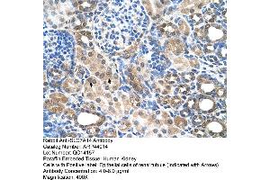 Human kidney (SLC7A14 antibody  (N-Term))