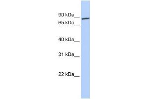 WB Suggested Anti-AR Antibody Titration: 0. (Androgen Receptor antibody  (N-Term))