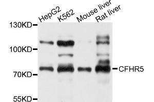 Western blot analysis of extracts of various cell lines, using CFHR5 antibody (ABIN5997428) at 1/1000 dilution. (CFHR5 antibody)