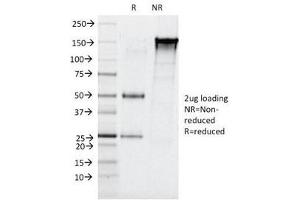 SDS-PAGE Analysis of Purified, BSA-Free Elastase 3B Antibody (clone CELA3B/1257). (Elastase 3B antibody  (AA 82-238))