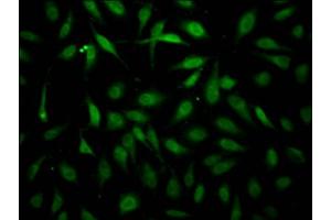 Immunofluorescence staining of Hela Cells with ABIN7127474 at 1:50, counter-stained with DAPI. (Recombinant ErbB2/Her2 antibody)