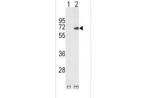 Western blot analysis of SD4 (arrow) using rabbit polyclonal SD4 Antibody (C-term) (ABIN652388 and ABIN2841883). (SMAD4 antibody  (C-Term))