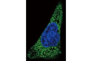 Immunofluorescence (IF) image for anti-Solute Carrier Family 11 (Proton-Coupled Divalent Metal Ion Transporters), Member 2 (SLC11A2) antibody (ABIN2997547) (SLC11A2 antibody)