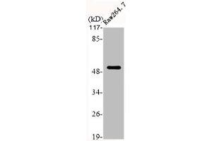 Western Blot analysis of RAE264. (Cytokeratin 7 antibody  (C-Term))