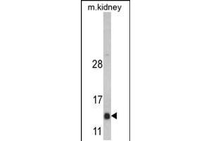 Western blot analysis of DNAJC19 Antibody in mouse kidney tissue lysates (35ug/lane) (DNAJC19 antibody  (AA 55-84))