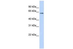 Image no. 1 for anti-Tumor Protein P53 (TP53) (AA 36-85) antibody (ABIN6742186) (p53 antibody  (AA 36-85))