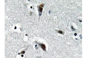 Immunohistochemistry analyzes of RFC3 antibody in paraffin-embedded human brain tissue. (RFC3 antibody)