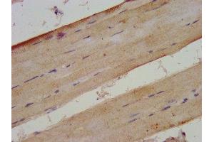 IHC image of ABIN7175925 diluted at 1:300 and staining in paraffin-embedded human skeletal muscle tissue performed on a Leica BondTM system. (XIRP2 antibody  (AA 2861-3004))