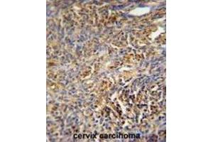 Immunohistochemistry (IHC) image for anti-TRAF Family Member-Associated NFKB Activator (TANK) antibody (ABIN3002470) (TANK antibody)