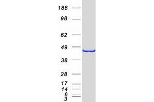 MTRF1L Protein (Transcript Variant 1) (Myc-DYKDDDDK Tag)