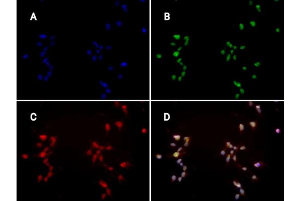 FcRn antibody