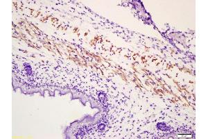 Formalin-fixed and paraffin embedded mouse embryonic muscle labeled with Anti-Phospho-MYL(Ser19) Polyclonal Antibody, Unconjugated (ABIN744188) at 1:200 followed by conjugation to the secondary antibody and DAB staining (PML antibody  (pSer19))