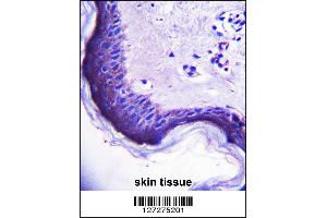 ERV3 Antibody immunohistochemistry analysis in formalin fixed and paraffin embedded human skin tissue followed by peroxidase conjugation of the secondary antibody and DAB staining. (ERV3 antibody  (C-Term))