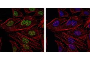 Immunofluorescence (IF) image for anti-BMI1 Polycomb Ring Finger Oncogene (BMI1) antibody (ABIN968985)