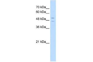 STEAP3 antibody used at 5 ug/ml to detect target protein. (STEAP3 antibody  (N-Term))