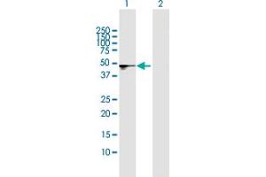 Western Blot analysis of SMPDL3B expression in transfected 293T cell line by SMPDL3B MaxPab polyclonal antibody. (SMPDL3B antibody  (AA 1-373))