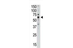 Western Blotting (WB) image for anti-Sialic Acid Binding Ig-Like Lectin 5 (SIGLEC5) antibody (ABIN2998610) (SIGLEC5 antibody)