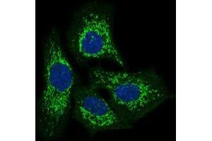 Immunofluorescence (IF) image for anti-Twinfilin, Actin-Binding Protein 1 (TWF1) (AA 335-384) antibody (ABIN1098116)