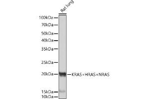 Western blot analysis of extracts of Rat lung, using KRAS+HRAS+NRAS Rabbit mAb (ABIN7267531) at 1:1000 dilution. (GTPase NRas antibody)