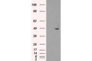 HEK293T cells were transfected with the pCMV6-ENTRY control (Left lane) or pCMV6-ENTRY SORD (Right lane) cDNA for 48 hrs and lysed. (SORD antibody)