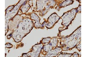 Immunoperoxidase of monoclonal antibody to TFRC on formalin-fixed paraffin-embedded human placenta. (Transferrin Receptor antibody  (AA 68-168))