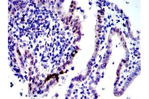 Immunohistochemistry (IHC) image for anti-Jun Proto-Oncogene (JUN) antibody (ABIN968994)