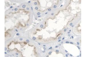 DAB staining on IHC-P; Samples: Human Kidney Tissue (TBXA2R antibody  (AA 3-324))