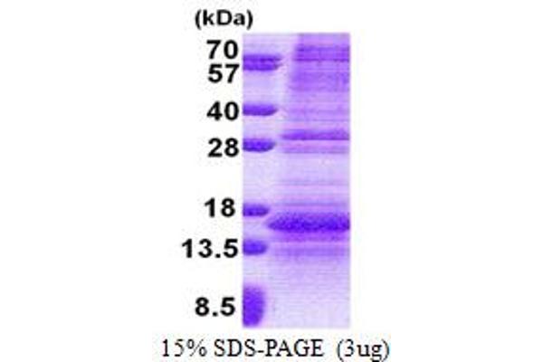 Norrie Disease (Pseudoglioma) Protein (NDP) (AA 25-133) (His tag)