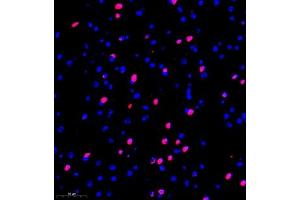 Immunofluorescence of paraffin embedded mouse brain using kb12 (ABIN7075406) at dilution of 1:700 (300x lens) (p130 antibody)