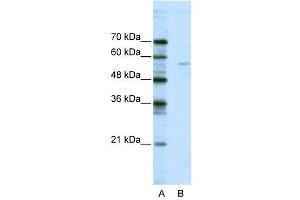 WB Suggested Anti-ELK1  Antibody Titration: 2. (ELK1 antibody  (N-Term))