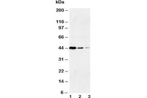 Western blot testing of Caspase-1 antibody and Lane 1:  Jurkat;  2: Raji;  3: CEM (Caspase 1 antibody  (Large Subunit, N-Term))