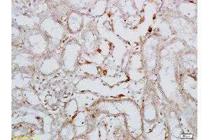 Immunohistochemistry (Paraffin-embedded Sections) (IHC (p)) image for anti-Selectin L (SELL) (AA 301-372) antibody (ABIN736716)