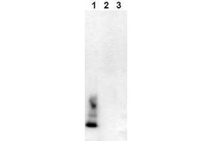 Western Blotting (WB) image for anti-Amyloid beta (Abeta) (AA 1-40), (C-Term), (N-Term) antibody (Biotin) (ABIN126717) (beta Amyloid antibody  (C-Term, N-Term) (Biotin))