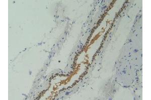 IHC-P analysis of Mouse Skeletal muscle Tissue, with DAB staining. (Corin antibody  (AA 334-477))