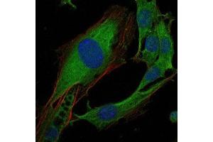 Immunofluorescence (IF) image for anti-V-Crk Sarcoma Virus CT10 Oncogene Homolog (Avian) (CRK) antibody (ABIN969062)