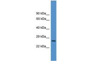 Image no. 1 for anti-CD8a Molecule (CD8A) (AA 91-140) antibody (ABIN6745375) (CD8 alpha antibody  (AA 91-140))