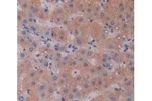 Used in DAB staining on fromalin fixed paraffin- embedded liver tissue (Phospholipase C delta 3 antibody  (AA 528-789))