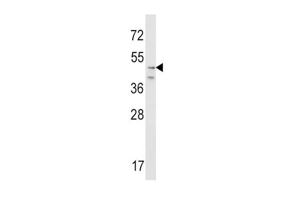 CRHR2 antibody  (N-Term)