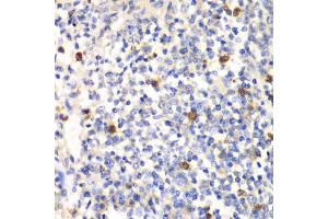 Immunohistochemistry of paraffin-embedded mouse spleen using PSMD7 antibody (ABIN5973092) at dilution of 1/100 (40x lens). (PSMD7 antibody)