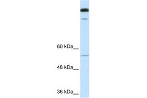 Western Blotting (WB) image for anti-Timeless Homolog (TIMELESS) antibody (ABIN2460886) (TIMELESS antibody)