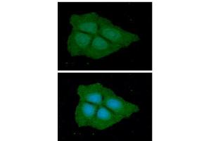 ICC/IF analysis of PGD in Hep3B cells line, stained with DAPI (Blue) for nucleus staining and monoclonal anti-human PGD antibody (1:100) with goat anti-mouse IgG-Alexa fluor 488 conjugate (Green). (PGD antibody)