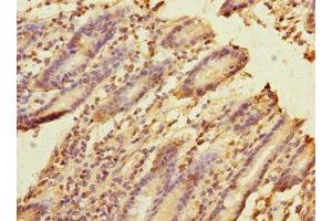 Immunohistochemistry of paraffin-embedded human duodenal tissue using ABIN7152685 at dilution of 1:100 (FRMD6 antibody  (AA 413-622))