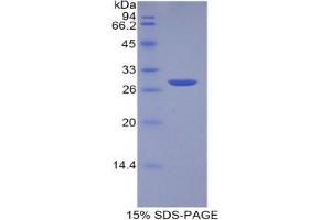 SDS-PAGE analysis of Human TPT1 Protein. (TPT1 Protein)